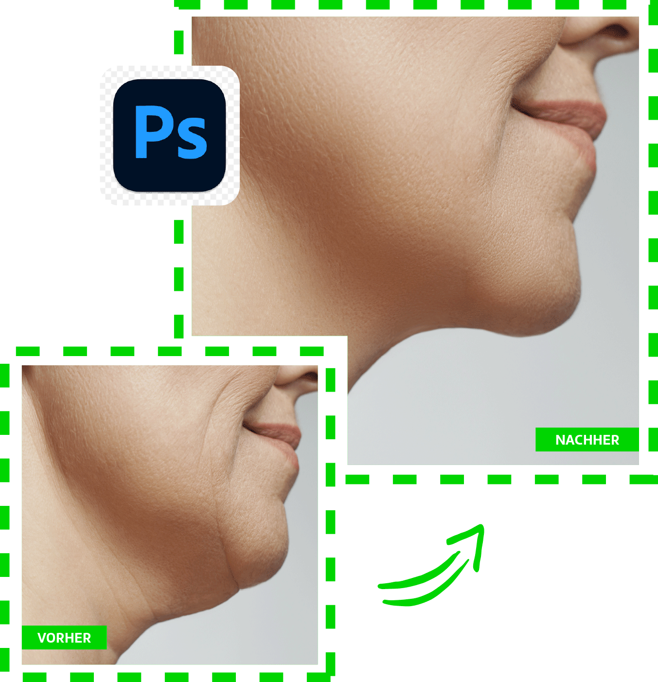 doppelkinn-entfernen-lassen-photoshop2